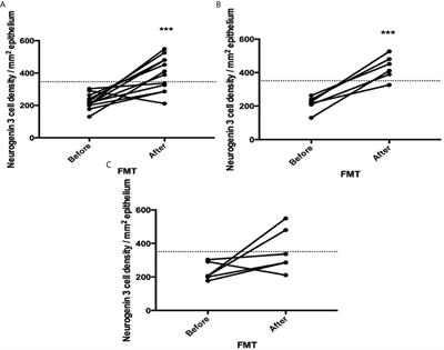 The Effects of Fecal Microbiota Transplantation on the Symptoms and the Duodenal Neurogenin 3, Musashi 1, and Enteroendocrine Cells in Patients With Diarrhea-Predominant Irritable Bowel Syndrome